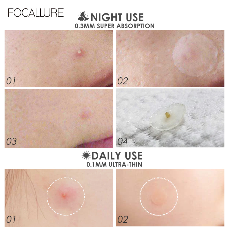 FA186 - Focallure ACNE PIMPLE Night Patch